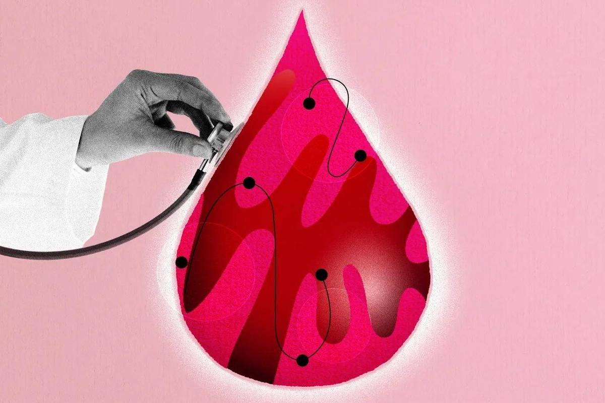 Não sabia que 'de chico' vem de chiqueiro? Este não é o ponto