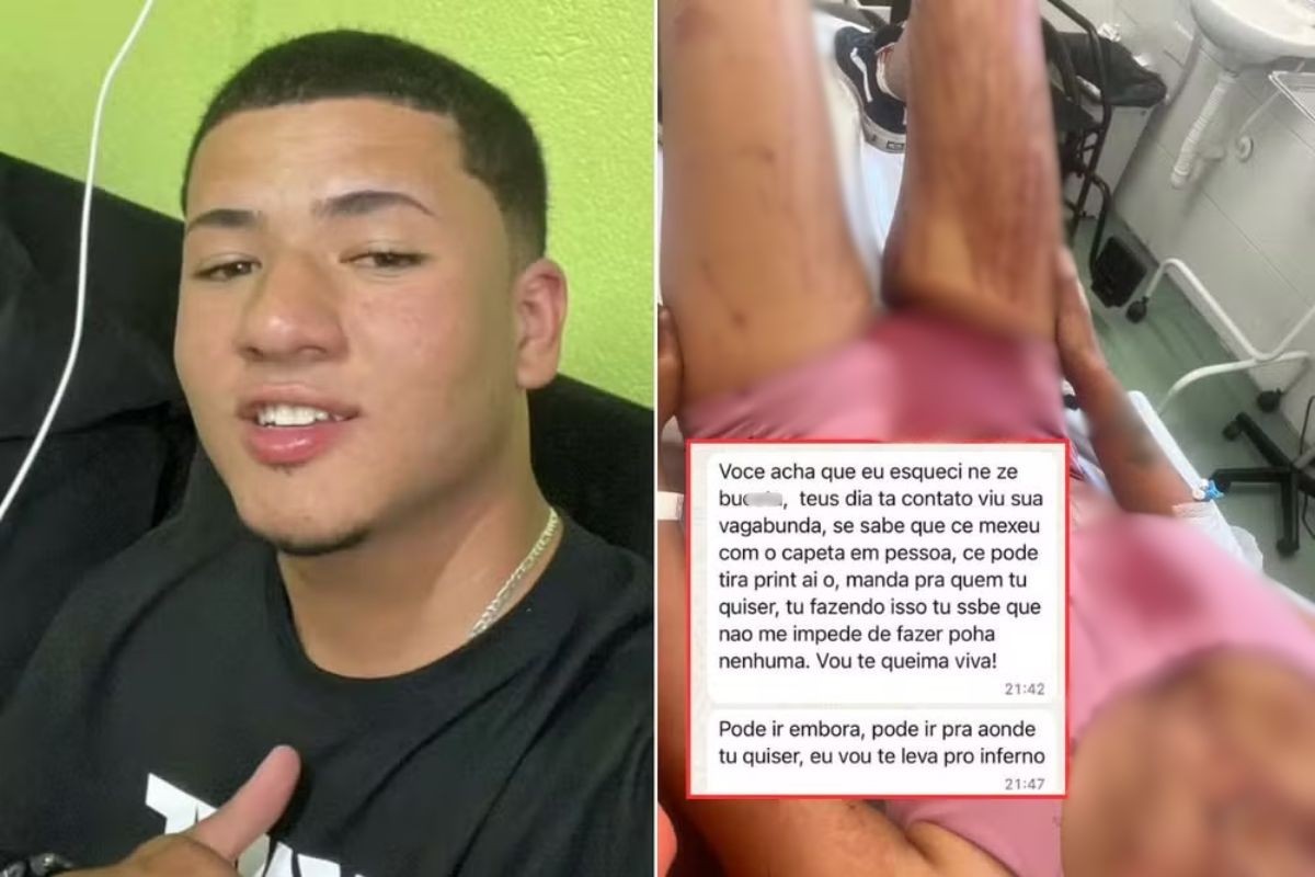Homem é queimado com água fervendo ao invadir casa da ex em SP